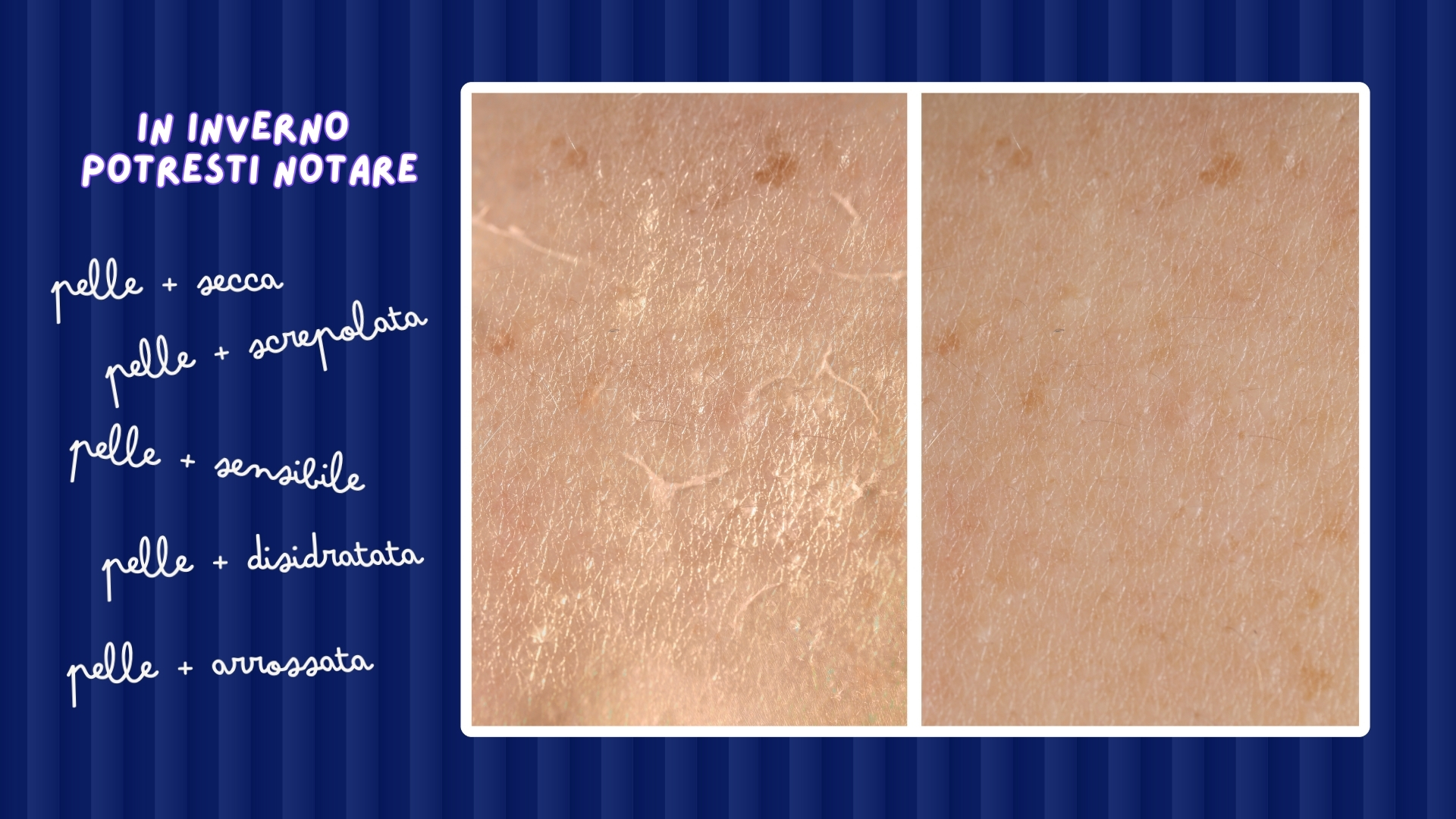 Pelle del viso secca e screpolata a causa del freddo