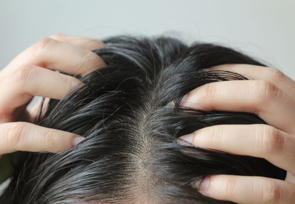 Capelli Grassi: cause, rimedi efficaci e prodotti per ridurre il sebo